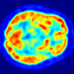 סריקת מוח PET. מקור: ויקיפדיה ברישיון. צילום: Jens Langner