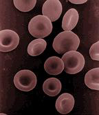 תאי דם אדומים. מקור: ויקידפיה. ברשיון. צילום: Us National Institutes of Health