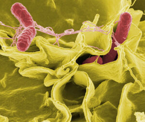 אנטיביוטיקה נגד חיידקים. חיידקי סלמונה חודרים לתאים אנושיים. צילום: Us National Institutes of Health