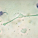 תא דם לבן מסוג מקרופאג. מקור: ויקיפדיה ברשיון cc2-by-sa. צילום: magnaram obli Lingulidas