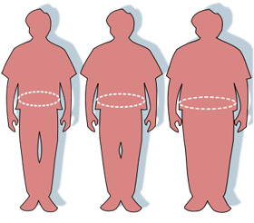 השמנה ועודף משקל. מקור: ויקיפדיה רשיון PD. איור באדיבותUS-FDA. Pharos Victovoi
