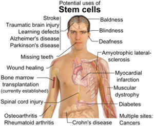 פוטנציאל טיפולי בתאי גזע עובריים. מקור: ויקיפדיה ברשיון חופשי. אילוסטרציה: Mikael Haggstrom