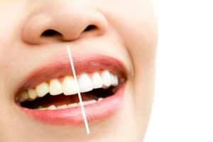 טיפולי שיניים לסוגיהםהחל מהלבנת שיניים ועד השתלת שיניים או טיפול שורש. צילום: Freepik
