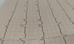 מה קורה כשיש התקף לב ומה הסכנה באירוע לב? צילום: Régis OBYDOL Pixabay